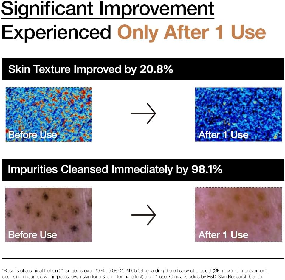 ANUA – RICE ENZYME BRIGHTENING CLEANSING POWDER / RICE MASK